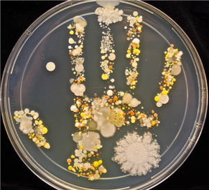 5 loài vi khuẩn đáng sợ trên bàn tay bạn
